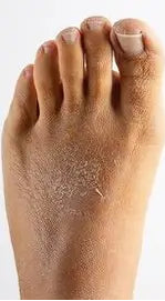 Before transformation