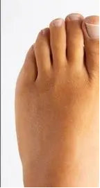 After transformation