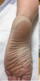 Before transformation