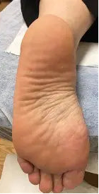 After transformation