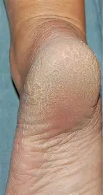 Before transformation