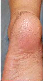 After transformation